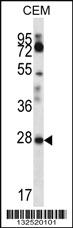 Anti-RARRES1 Rabbit Polyclonal Antibody