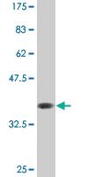 Anti-CBFA2T2 Mouse Monoclonal Antibody [clone: 2C10]