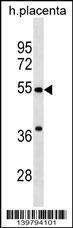 Anti-CHST2 Rabbit Polyclonal Antibody (HRP (Horseradish Peroxidase))