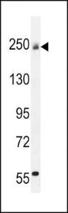 Anti-COL5A1 Rabbit Polyclonal Antibody (APC (Allophycocyanin))