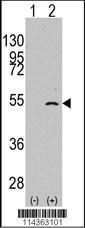 Anti-ELP3 Rabbit polyclonal antibody