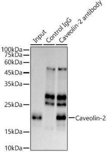 Immunoprecipitation analysis of 300µg extracts of HeLa cells using 3µg of Anti-Caveolin-2 Antibody [ARC0323] (A307368). This Western blot was performed on the immunoprecipitate using Anti-Caveolin-2 Antibody [ARC0323] (A307368) at a dilution of 1:1000.