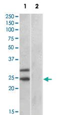 Anti-SOCS1 Goat Polyclonal Antibody