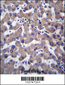 Anti-TMEM70 Rabbit Polyclonal Antibody (HRP (Horseradish Peroxidase))