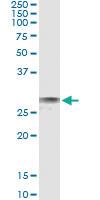 Anti-EXOSC3 Mouse Monoclonal Antibody [clone: 3E5]