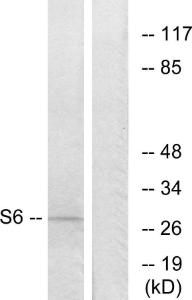 Western blot analysis of lysates from 293 cells, treated with serum 10% 15' using Anti-S6 Ribosomal Protein Antibody The right hand lane represents a negative control, where the antibody is blocked by the immunising peptide