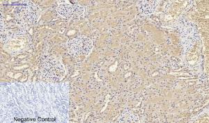 Immunohistochemical analysis of paraffin-embedded human kidney tissue using Anti-IL8 Antibody at 1:200 (4°C overnight). Negative control was secondary antibody only.