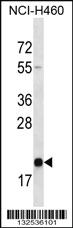 Anti-TMED2 Rabbit Polyclonal Antibody