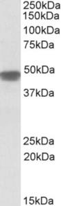 EB10189 (0.1 µg/ml) staining of Human Heart lysate (35 µg protein in RIPA buffer). Primary incubation was 1 hour. Detected by chemiluminescence.