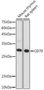 Western blot analysis of extracts of various cell lines, using Anti-CD70 Antibody (A308344) at 1:1000 dilution