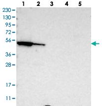 Anti-FAR1 Rabbit Polyclonal Antibody