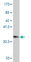 Anti-ZNF155 Mouse Monoclonal Antibody [clone: 2F11]