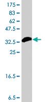 Anti-PLA2G12A Mouse Polyclonal Antibody