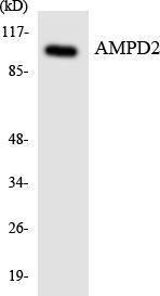 Anti-AMPD2 antibody