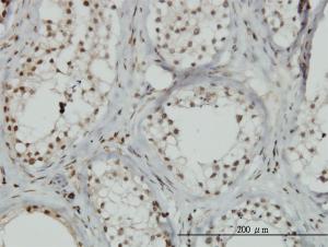 Anti-ZNF85 Mouse Monoclonal Antibody [clone: 2G9]