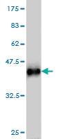 Anti-STK38 Mouse Monoclonal Antibody [clone: 6F1]