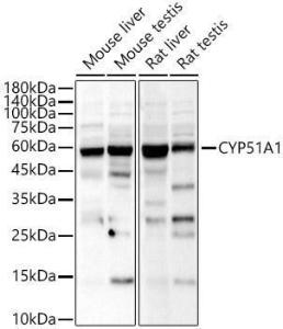 Western blot analysis of various lysates, using Anti-CYP51A1/CYP51 Antibody (A15131) at 1:800 dilution. The secondary Antibody was Goat Anti-Rabbit IgG H&L Antibody (HRP) at 1:10000 dilution. Lysates/proteins were present at 25 µg per lane