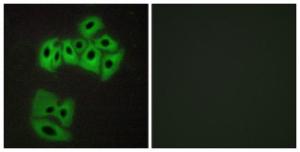 Immunofluorescence analysis of A549 cells using Anti-VAMP4 Antibody. The right hand panel represents a negative control, where the antibody was pre-incubated with the immunising peptide