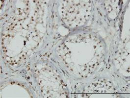 Anti-ZNF85 Mouse Monoclonal Antibody [clone: 2G9]