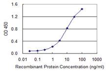 Anti-EXOSC3 Mouse Monoclonal Antibody [clone: 3E5]