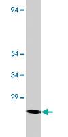 Anti-LOC677879 Rabbit Polyclonal Antibody