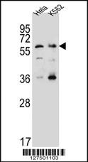 Anti-SLC22A4 Rabbit Polyclonal Antibody