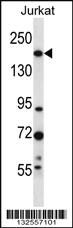 Anti-UGGT1 Rabbit Polyclonal Antibody