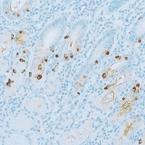 Anti-GAST Rabbit Polyclonal Antibody