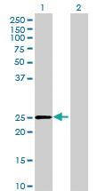 Anti-DHRS4L2 Mouse Polyclonal Antibody