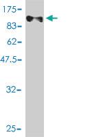 Anti-NFIC Mouse Monoclonal Antibody [clone: 1C12-2A2]