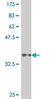 Anti-EPOR Mouse Polyclonal Antibody