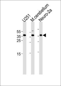 Anti-EMX1 Rabbit Polyclonal Antibody (AP (Alkaline Phosphatase))