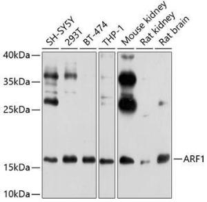 Western blot analysis of extracts of various cell lines, using Anti-ARF1 Antibody (A307374) at 1:1,000 dilution The secondary antibody was Goat Anti-Rabbit IgG H&L Antibody (HRP) at 1:10,000 dilution Lysates/proteins were present at 25 µg per lane