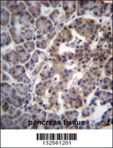 Anti-DNAJC14 Rabbit Polyclonal Antibody