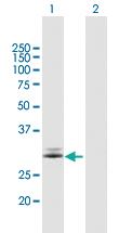 Anti-FAHD2A Mouse Polyclonal Antibody