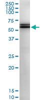 Anti-PCCB Polyclonal Antibody Pair