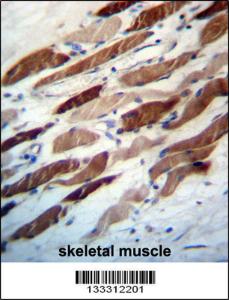 Anti-WIPI2 Rabbit Polyclonal Antibody (FITC (Fluorescein Isothiocyanate))