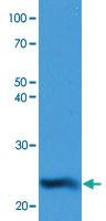 Anti-NQO2 Mouse Monoclonal Antibody [clone: AT1E3]