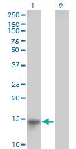 Anti-LRRC8D Mouse Monoclonal Antibody [clone: 3H1-1C2]