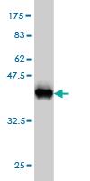 Anti-STK38 Mouse Monoclonal Antibody [clone: 2F3]