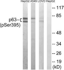 Western blot analysis of lysates from LOVO cells treated with nocodazole 1 µg/ml 18h, A549 cells treated with nocodazole 1 µg/ml 18h and HepG2 cells treated with nocodazole 1 µg/ml 18h using Anti-p63 (phospho Ser395) Antibody