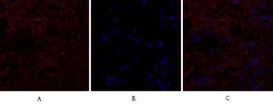 Immunofluorescence analysis of human breast cancer tissue using Anti-IL8 Antibody (red) at 1:200 (4°C overnight). Cy3 labelled secondary antibody was used at 1:300 (RT 50min). Panel A: Target. Panel B: DAPI. Panel C: Merge.