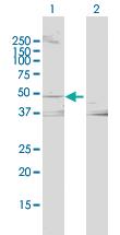 Anti-LCAT Rabbit Polyclonal Antibody