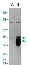 Anti-TFPI Goat Polyclonal Antibody