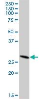 Anti-DHRS4L2 Mouse Polyclonal Antibody