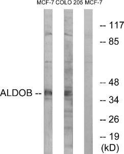 Western blot analysis of lysates from MCF-7 and HUVEC cells using Anti-ALDOB Antibody. The right hand lane represents a negative control, where the antibody is blocked by the immunising peptide