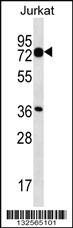 Anti-PLS1 Rabbit Polyclonal Antibody