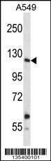 Anti-INSRR Rabbit Polyclonal Antibody (HRP (Horseradish Peroxidase))