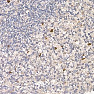 Immunohistochemistry analysis of paraffin-embedded human tonsil using Anti-NUR77 Antibody (A15327) at a dilution of 1:100 (40x lens). Perform high pressure antigen retrieval with 10 mM citrate buffer pH 6.0 before commencing with IHC staining protocol