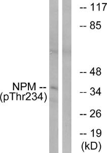 Western blot analysis of lysates from HeLa cells treated with nocodazole 1 µg/ml 18h using Anti-NPM (phospho Thr234) Antibody The right hand lane represents a negative control, where the antibody is blocked by the immunising peptide